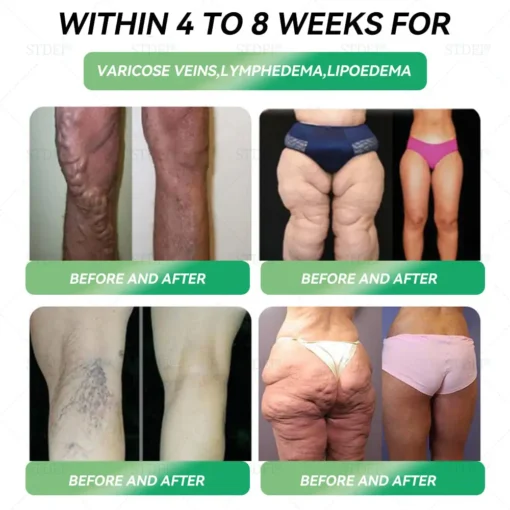 𝗪𝗮𝗿𝗺𝗙𝗮𝗺𝗶𝗹𝘆® 𝐆𝐋𝐏-𝟏 𝐒𝗹𝐢𝐦𝐦𝐢𝐧𝐠 𝐇𝐞𝐚𝗹𝐭𝐡 𝐈𝐦𝐩𝐫𝐨𝐯𝐞𝐦𝐞𝐧𝐭 𝐀𝐦𝐩𝐨𝐮𝗹𝐞 𝐃𝐫𝐨𝐩𝐬
