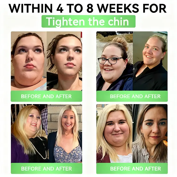 ๐๐๐ง๐ข๐๐๐ข๐๐ก๐ฎยฎ ๐๐๐ฃ-๐ญ ๐-๐ถ๐ป-๐ญ ๐ฆ๐น๐ถ๐บ & ๐ฏ๐๐๐๐๐๐ฒ ๐ถ๐๐๐ ๐บ๐๐๐๐๐๐๐