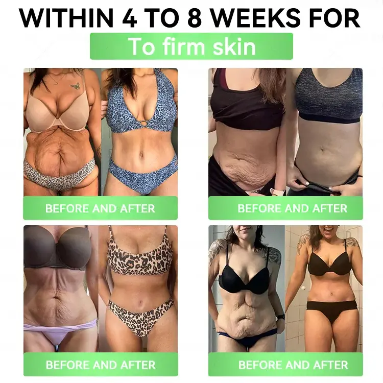 ๐๐๐ง๐ข๐๐๐ข๐๐ก๐ฎยฎ ๐๐๐ฃ-๐ญ ๐-๐ถ๐ป-๐ญ ๐ฆ๐น๐ถ๐บ & ๐ฏ๐๐๐๐๐๐ฒ ๐ถ๐๐๐ ๐บ๐๐๐๐๐๐๐